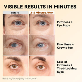 RONKIE application under eye demo showing quick visible tightening