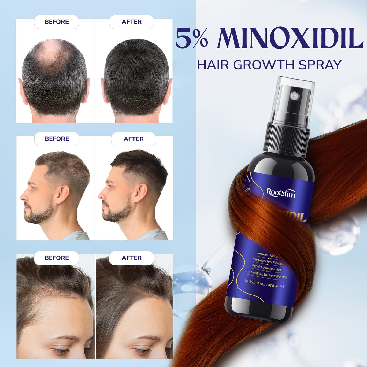 RootStim applied to thinning scalp demonstrating targeted coverage