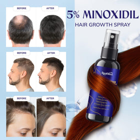 RootStim applied to thinning scalp demonstrating targeted coverage