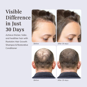 RootStim botanical ingredients layout with rosemary and biotin, emphasizing natural-strengthening benefits