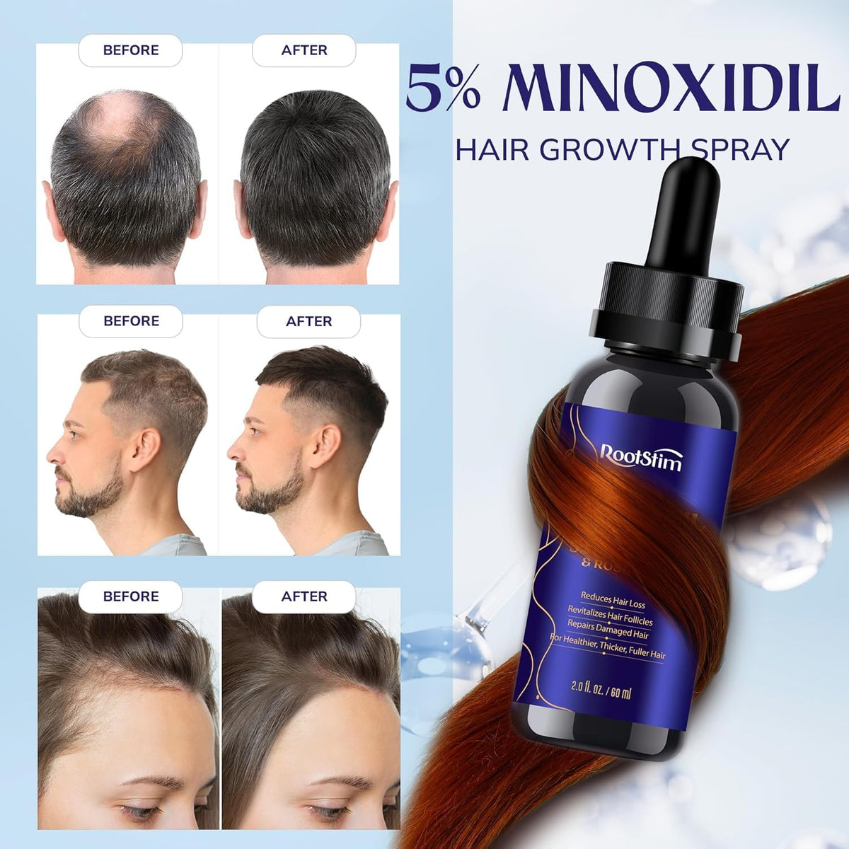 RootStim being sprayed on scalp to target thinning areas for coverage