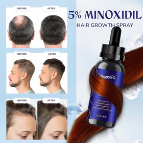 RootStim being sprayed on scalp to target thinning areas for coverage