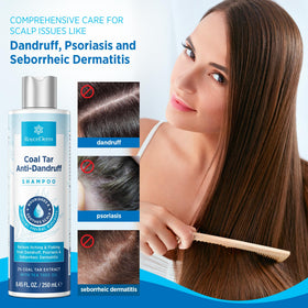 RoyceDerm before and after scalp image showing visible flake reduction benefit