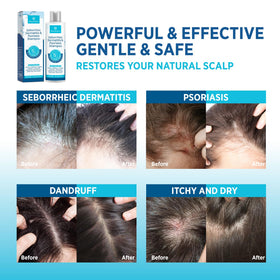 Roycederm product in hand being dispensed for precise application