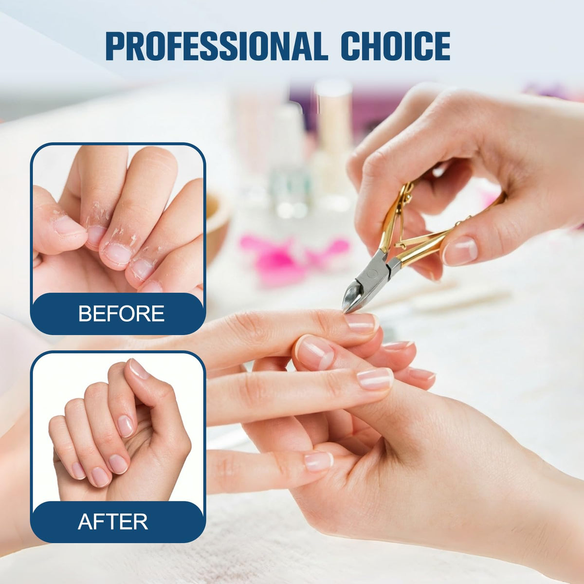 RTTTHEL travel manicure kit with nippers, portable convenience benefit
