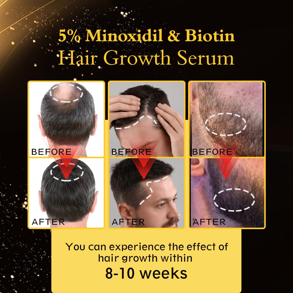 Ruahouine label close-up showing minoxidil, biotin, caffeine benefits