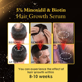 Ruahouine label close-up showing minoxidil, biotin, caffeine benefits