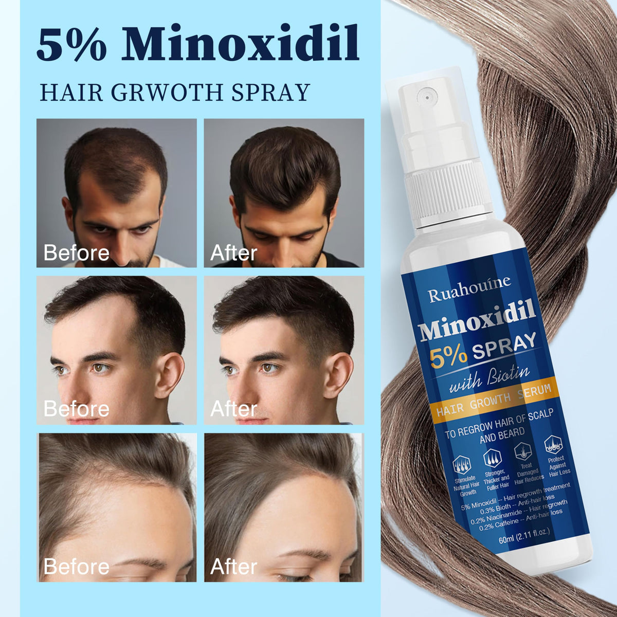 Ruahouine ingredient label close-up showing minoxidil and supporting actives