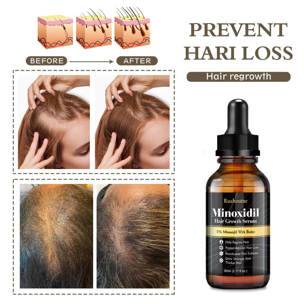 Hand applying Ruahouine serum to scalp demonstrating easy, precise twice-daily use