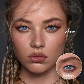Ruairie model wearing brown clusters showing subtle, natural enhancement