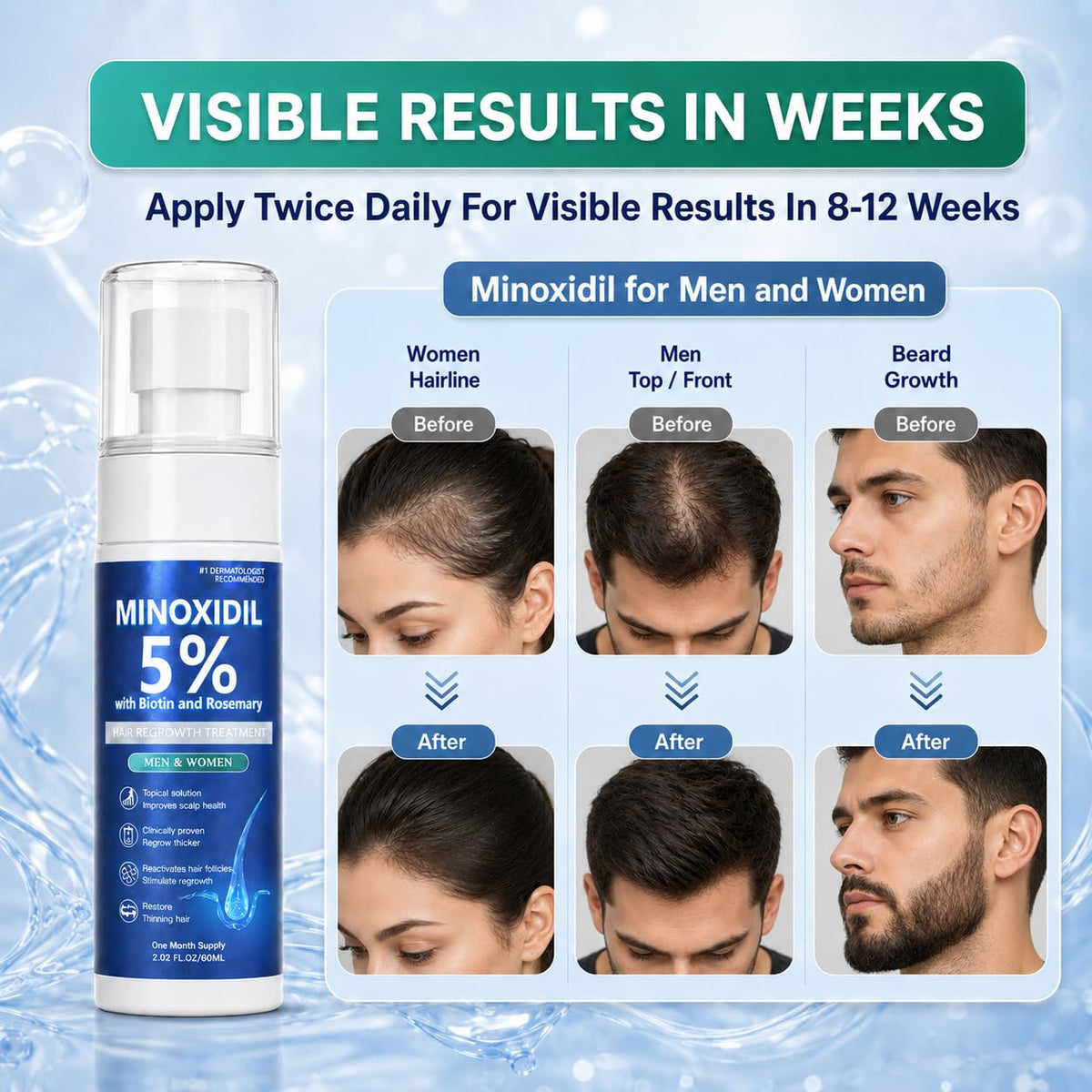 Rylx being applied to scalp illustrating targeted application benefit