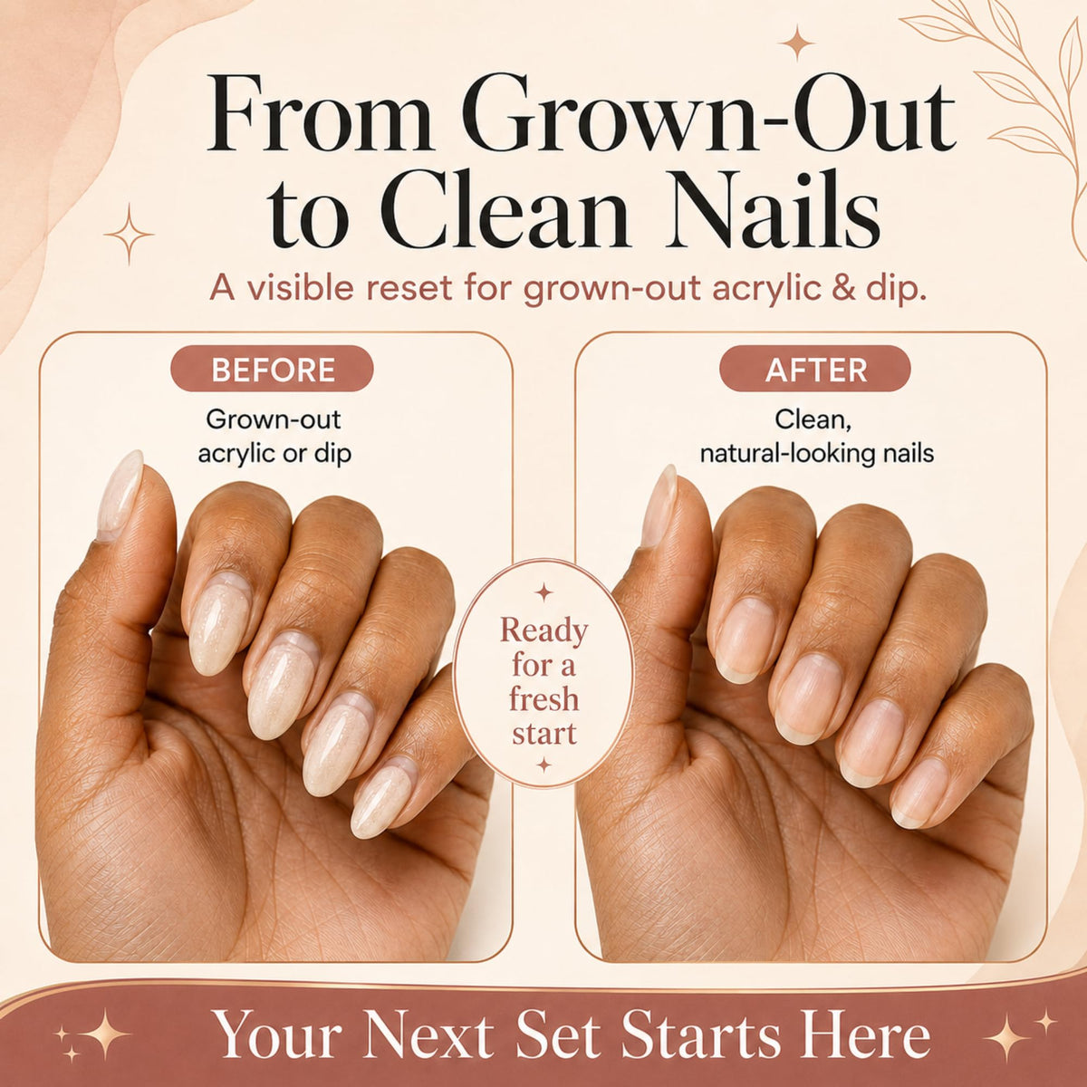 Saint Willo complete kit layout with tools for quick, tidy nail removal