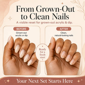 Saint Willo complete kit layout with tools for quick, tidy nail removal