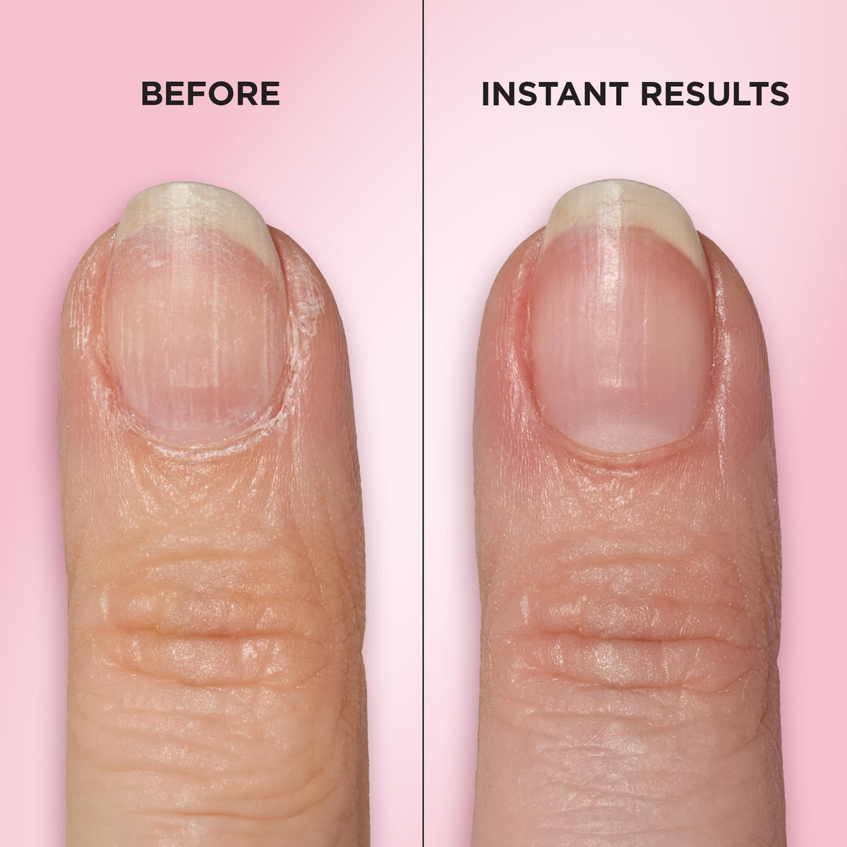 Close-up of Sally Hansen textured ceramic tip highlighting gentle exfoliation