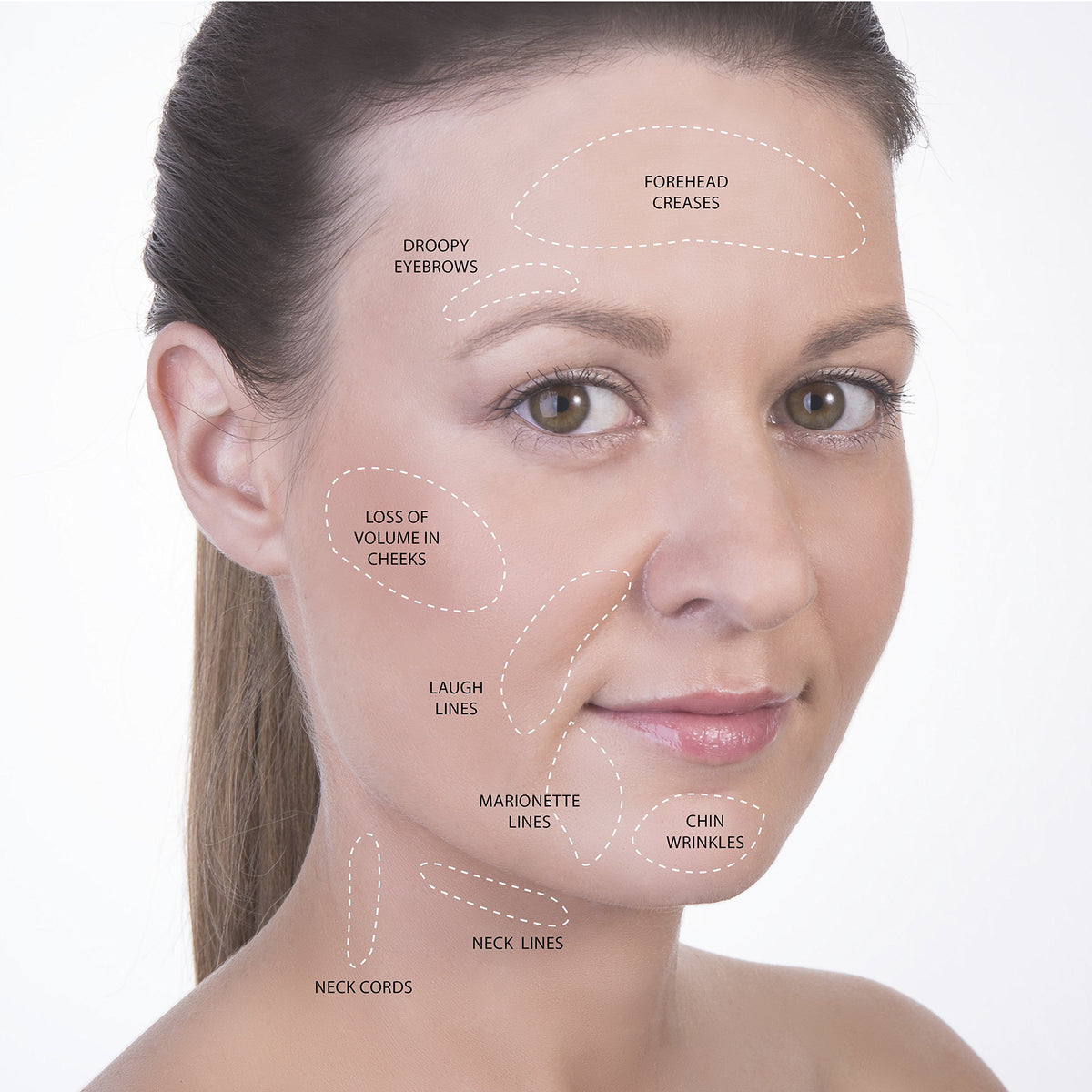 SanDine Silky Skin exfoliating brush detail prepping skin for better cupping glide