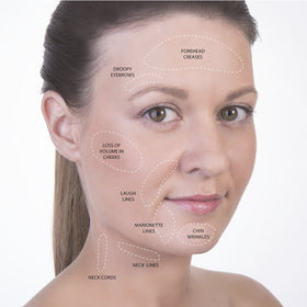 SanDine Silky Skin exfoliating brush detail prepping skin for better cupping glide