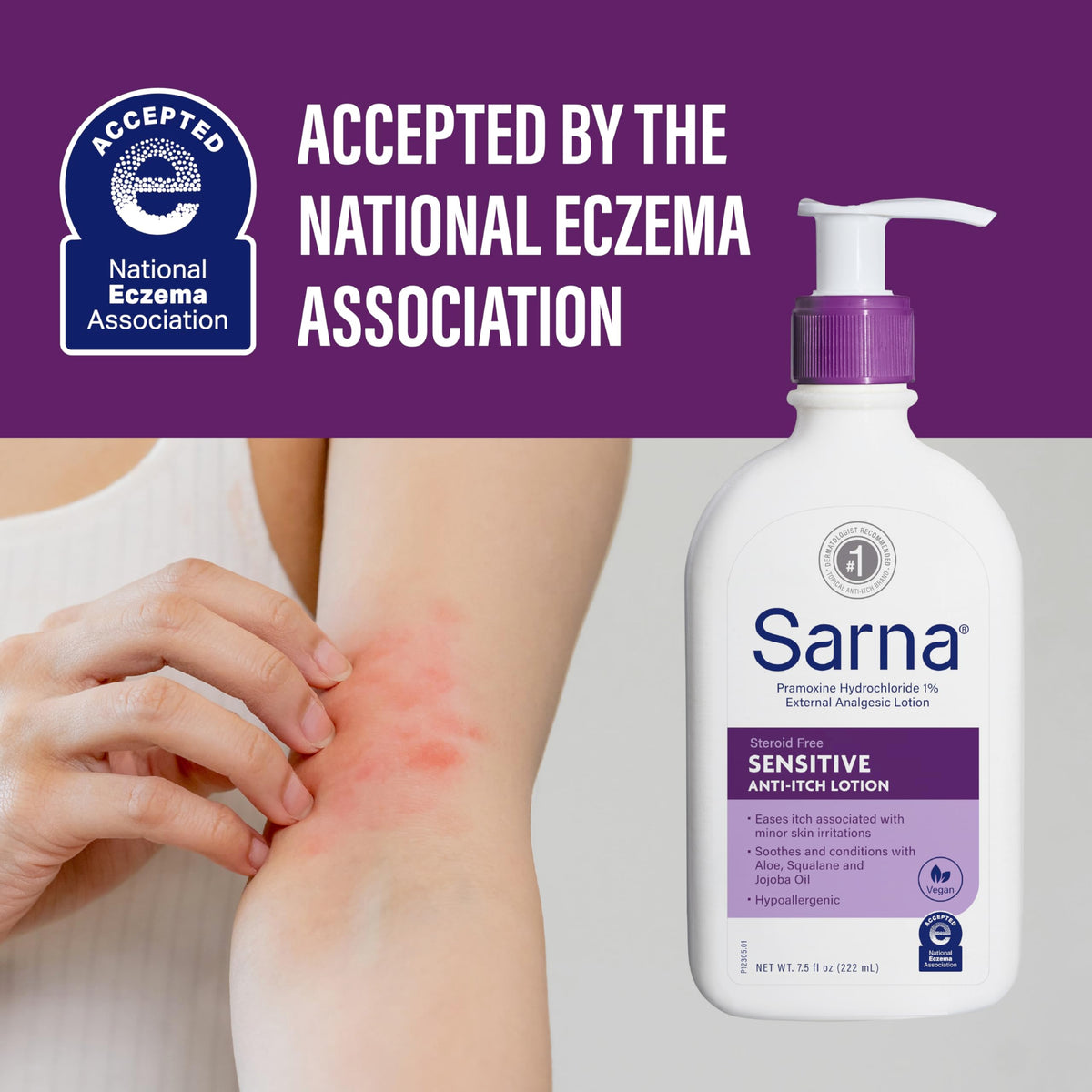 Sarna applied to forearm, brand soothing itch quickly and comfortably