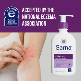 Sarna applied to forearm, brand soothing itch quickly and comfortably