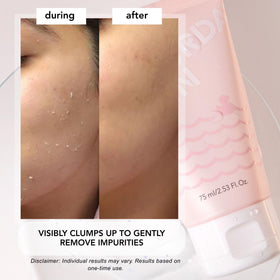 Saturday Skin cellulose rolls forming while massaging to lift dead skin