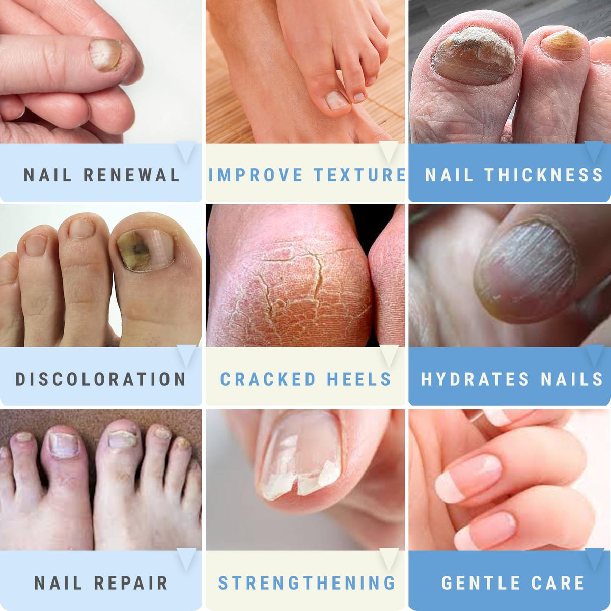 Scientific Solutions Global before and after toenail comparison demonstrating visible nail improvement
