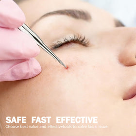 Screwizard stainless steel tool close-up highlighting tip shapes for precise extraction
