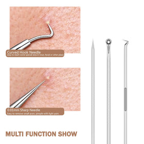 Screwizard tool in use on nose demonstrating targeted extraction for clearer pores
