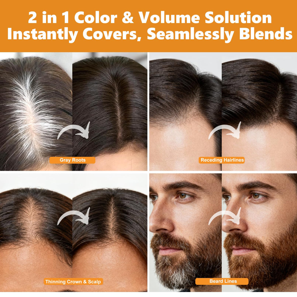 Seaboll application on thinning scalp adding visible fullness and coverage
