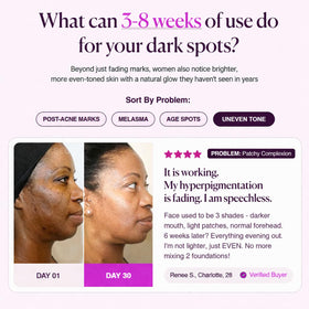 Seora Korean cream dispensed on hand showing easy application and absorption
