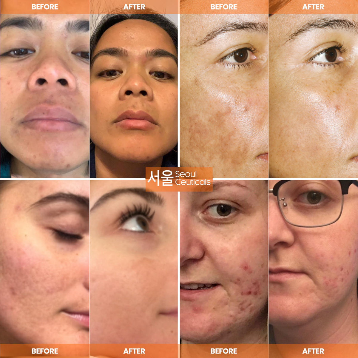 SeoulCeuticals close-up of serum texture highlighting lightweight hydration