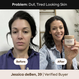 SERABEL used on lips and cheek showing gentle moisturizing benefit