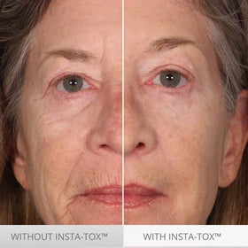 Serious Skincare INSTA-TOX applying under-eye to reduce visible bags and fine lines quickly