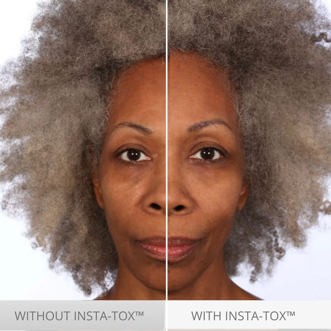 Serious Skincare INSTA-TOX before and after comparison showing diminished wrinkles and pores