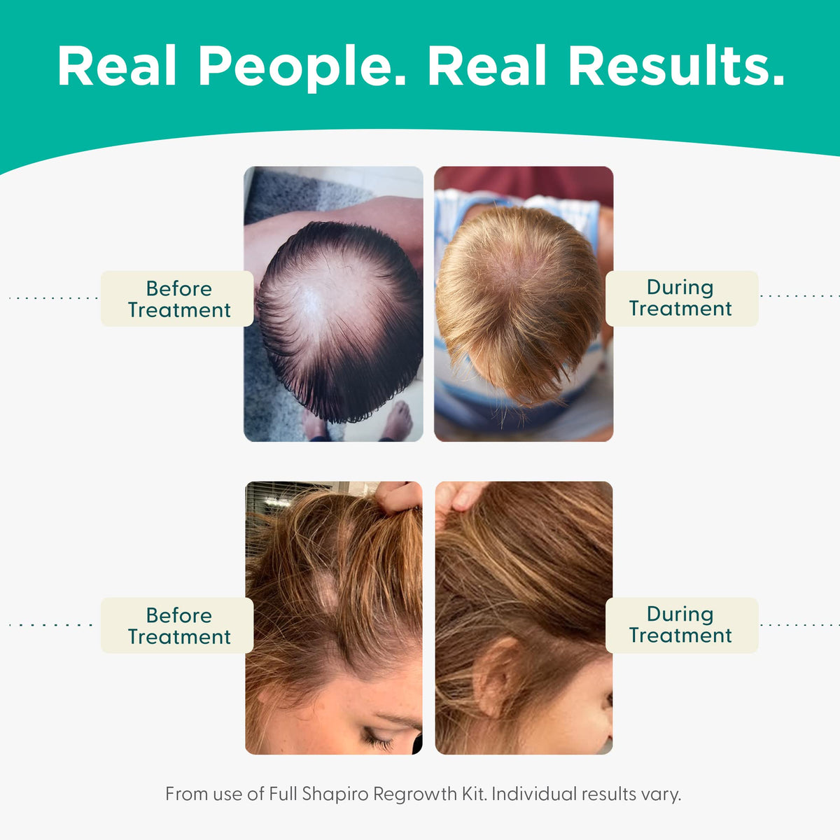 Shapiro MD foam placed in bathroom routine for daily use