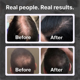 Shapiro MD shampoo dispensed in hand illustrating easy application and control