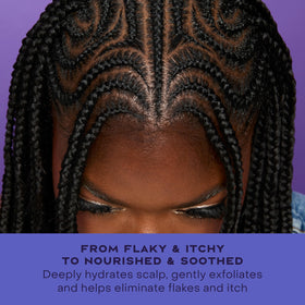 SheaMoisture before and after scalp comparison highlighting reduced flakes and comfort