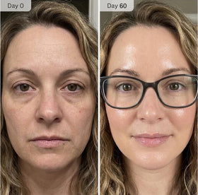 Shining Face applying stamp to neck to show targeted treatment and smoother appearance