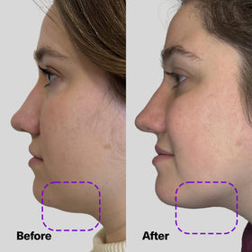 SickScience neck comparison with ruler for visible tightening and scale reference