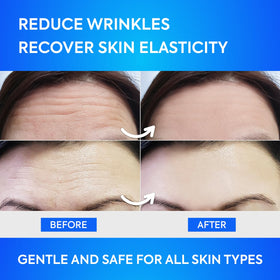 SILKDERMIS patch held in hand to show true size and easy application