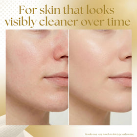 Silklean close-up of EF texture reducing friction for gentler care
