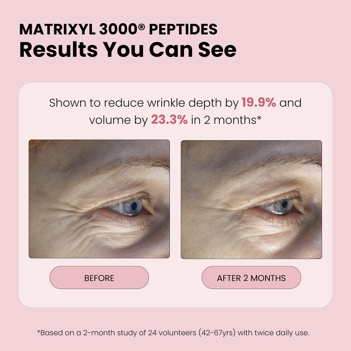 Simplified Skin label highlighting Matrixyl 3000 and ingredient benefits