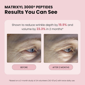 Simplified Skin label highlighting Matrixyl 3000 and ingredient benefits