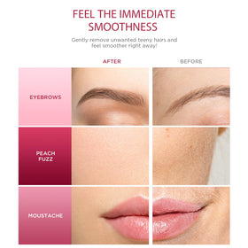 SINAHET before and after texture comparison showing improved skin smoothness