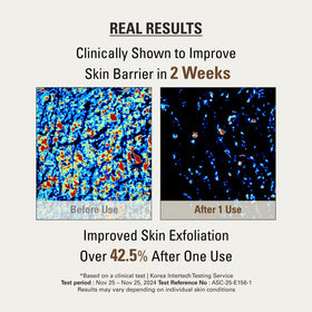 SIOT spot treatment applied to elbow showcasing smoothing and softening effect