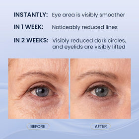 SKIN ULTIMA under-eye white cream texture providing hydration benefit