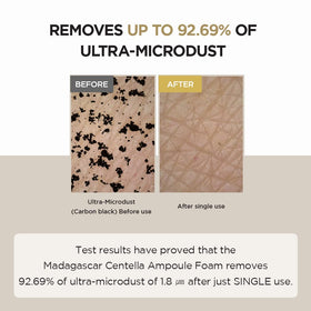 SKIN1004 foam in hand demonstrating soft cleansing and hydration