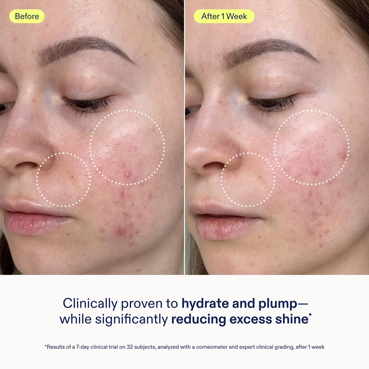 Skinfix product dispensed from pump demonstrating easy application