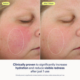 Skinfix gel-to-foam lather on hand demonstrating comfortable cleansing
