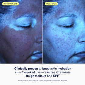 Skinfix gel texture on hand highlighting gentle, hydrating feel