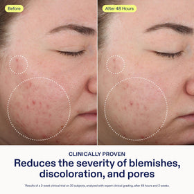 Skinfix lather texture close-up demonstrating gentle foaming benefit