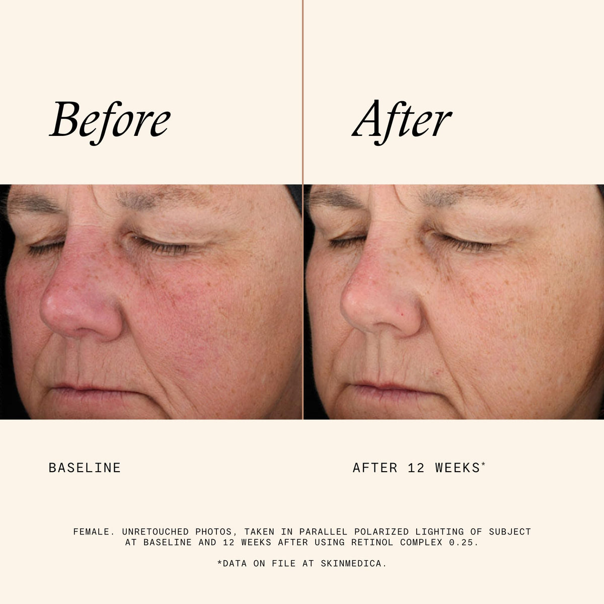 SkinMedica ingredient label focused on formulation transparency and confidence